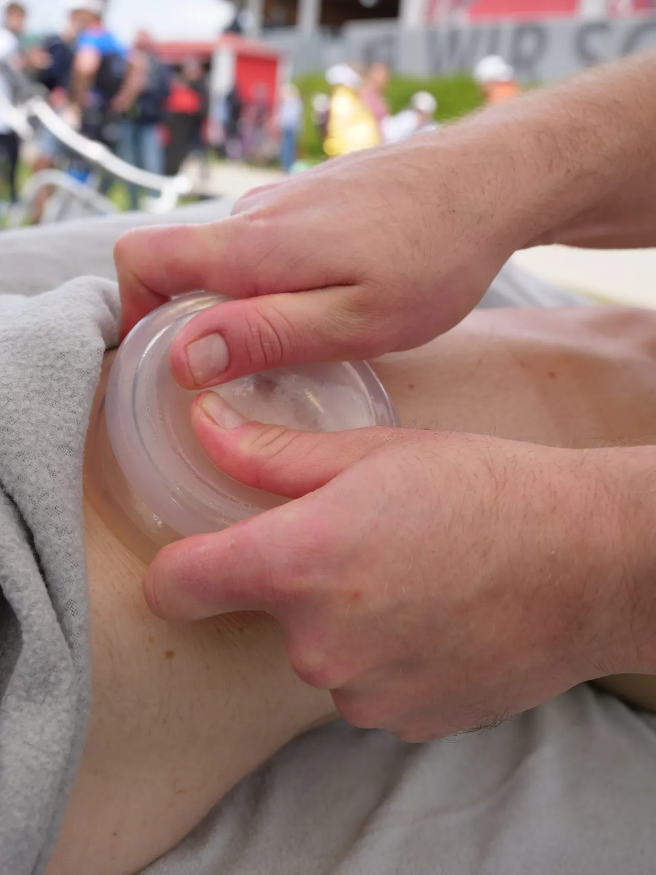 Schröpfen als Ergänzung zur Sportmassage in Wien